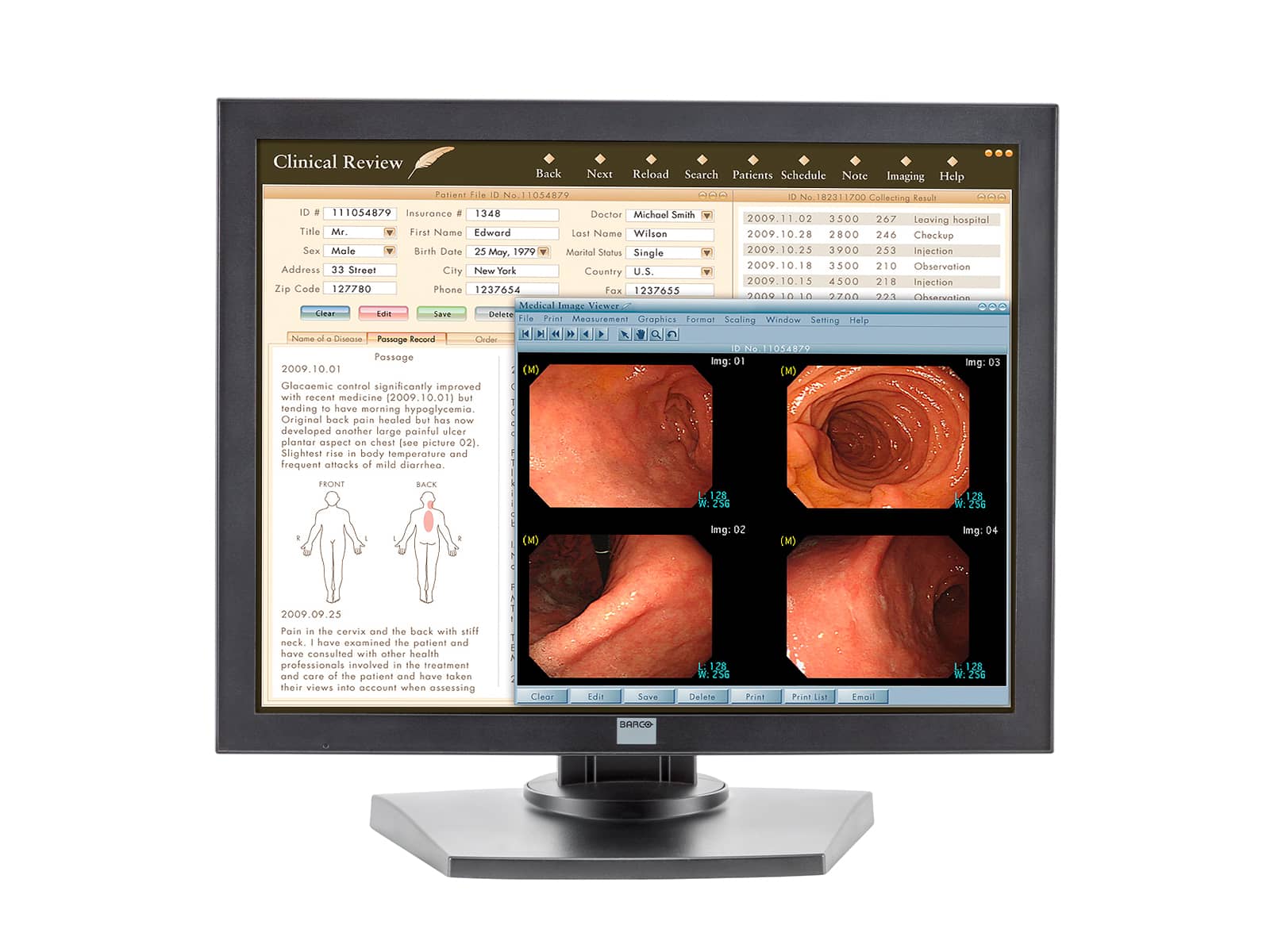 Barco Monitor de revisión clínica en color MDRC-2120 de 2MP y 20" (K9301900A) Monitors.com