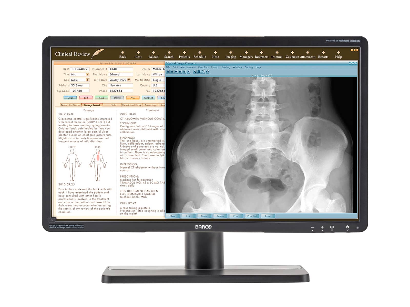 Barco Eonis MDRC-2224 2MP 24" Color LED Clinical Review Display Monitor (K9303005A) Monitors.com 