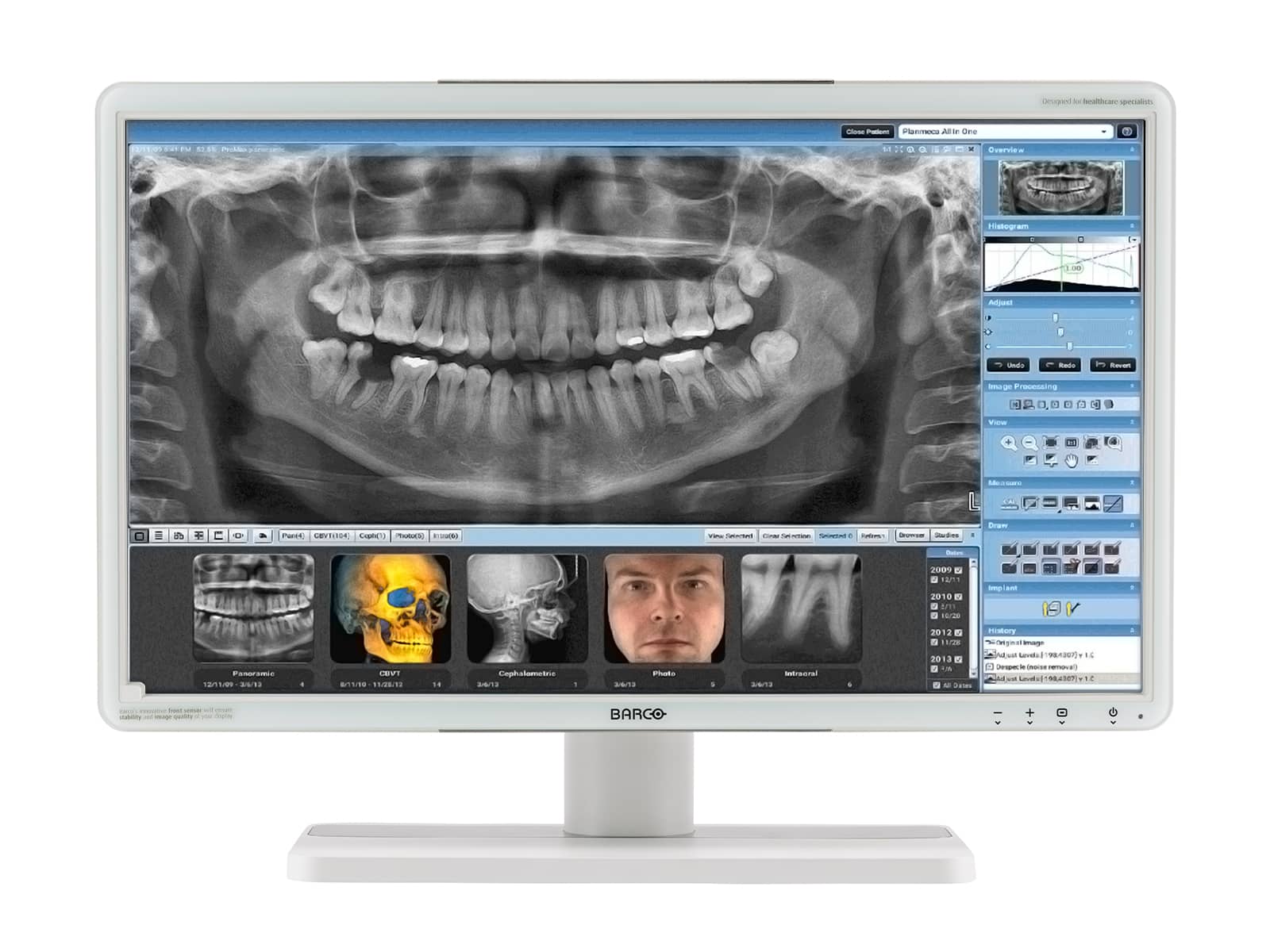Barco Eonis MDRC-2224 MKII 2MP 24" Color LED Clinical Review Display