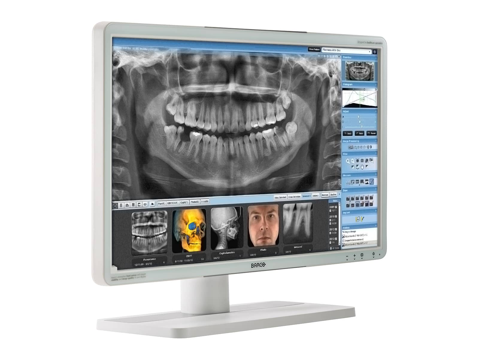 Barco Eonis MDRC-2224 MKII 2MP 24" Color LED Clinical Review Display Monitors.com 