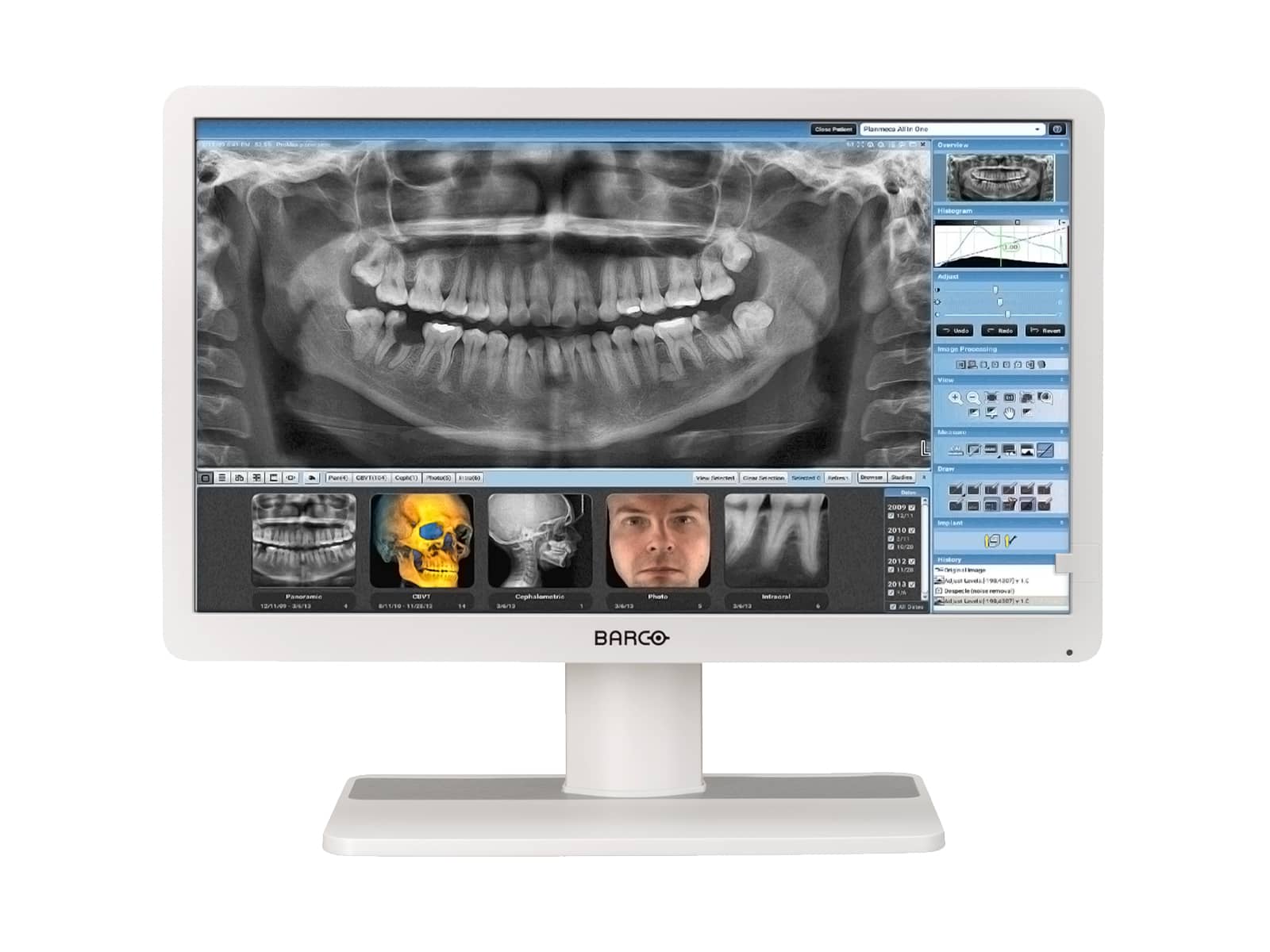 Barco Eonis MDRC-2222 (White) 2MP 22" Clinical Review LED Monitor (K9307945) Monitors.com 