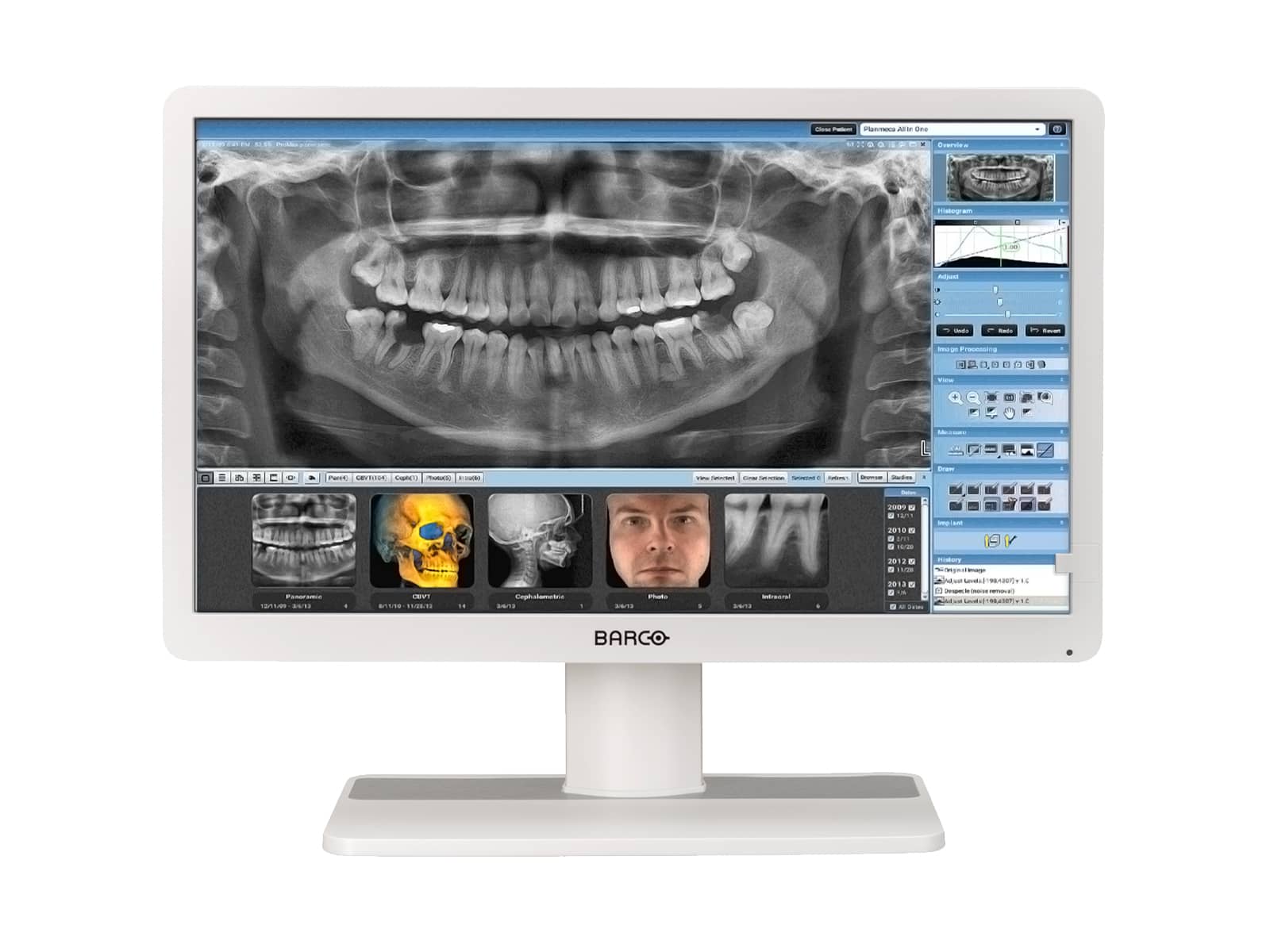 Barco Eonis MDRC-2222 WP 2MP 22" Klinischer Überprüfungs-LED-Monitor (K9307945)