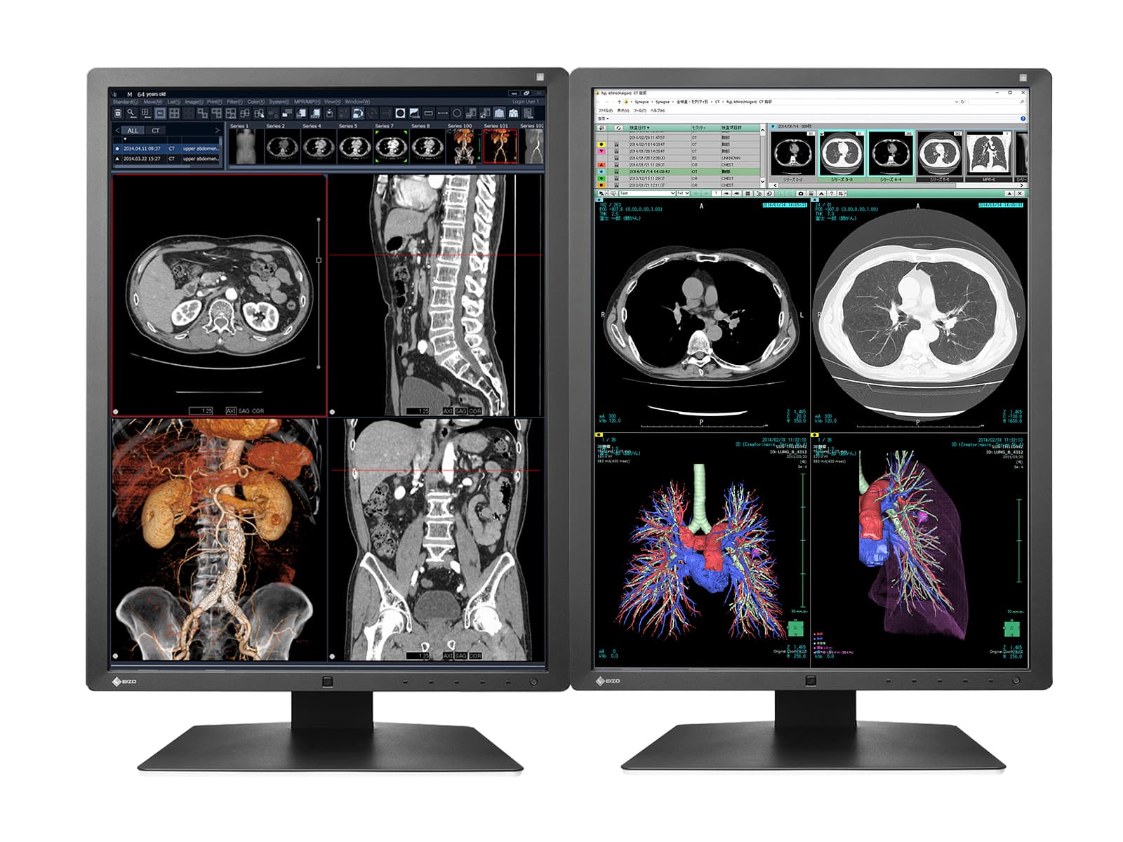 Eizo RadiForce RX250 2MP 21" Color LED Monitor de pantalla de radiología de diagnóstico médico (RX250-BK)