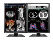 Eizo RadiForce RX250 Monitor di visualizzazione per radiologia diagnostica medica a colori da 21 pollici a colori da 2 MP (RX250-BK)