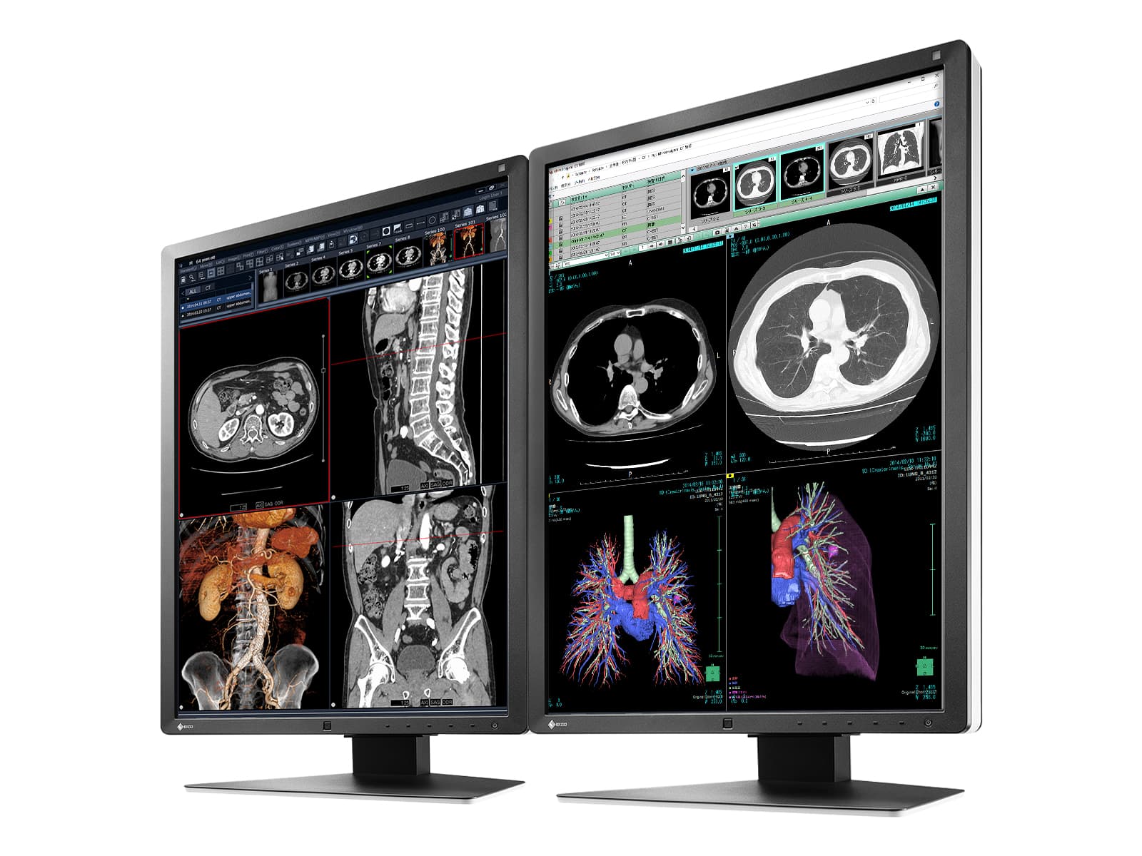 Eizo RadiForce RX250 2MP 21" Farb-LED-Monitor für medizinische Diagnose-Radiologie (RX250-BK)