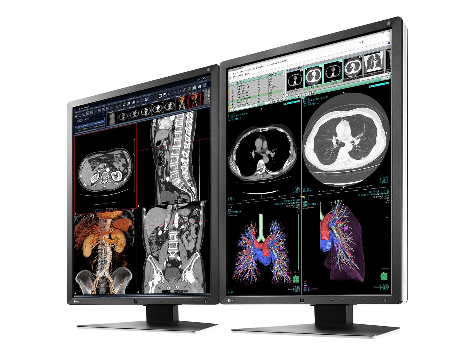 Eizo RadiForce RX250 2MP 21" Farb-LED-Monitor für medizinische Diagnostik und Radiologie (RX250-BK)