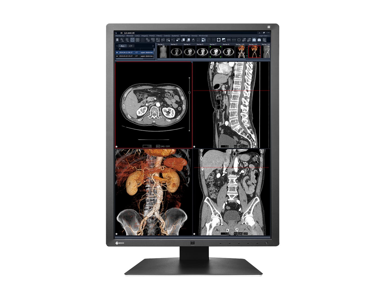 Eizo RadiForce RX250 2MP 21" Farb-LED-Monitor für medizinische Diagnose-Radiologie (RX250-BK)