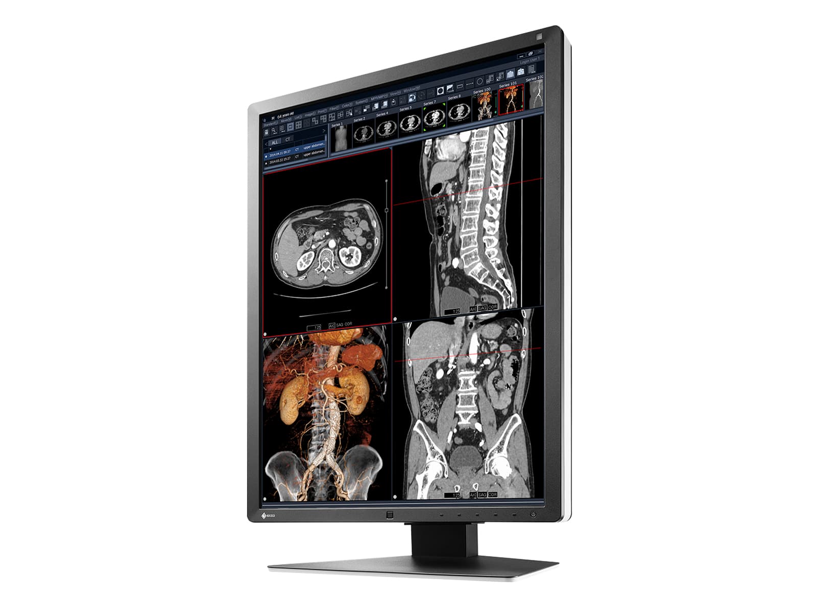 Eizo RadiForce RX250 2MP 21" Farb-LED-Monitor für medizinische Diagnose-Radiologie (RX250-BK)