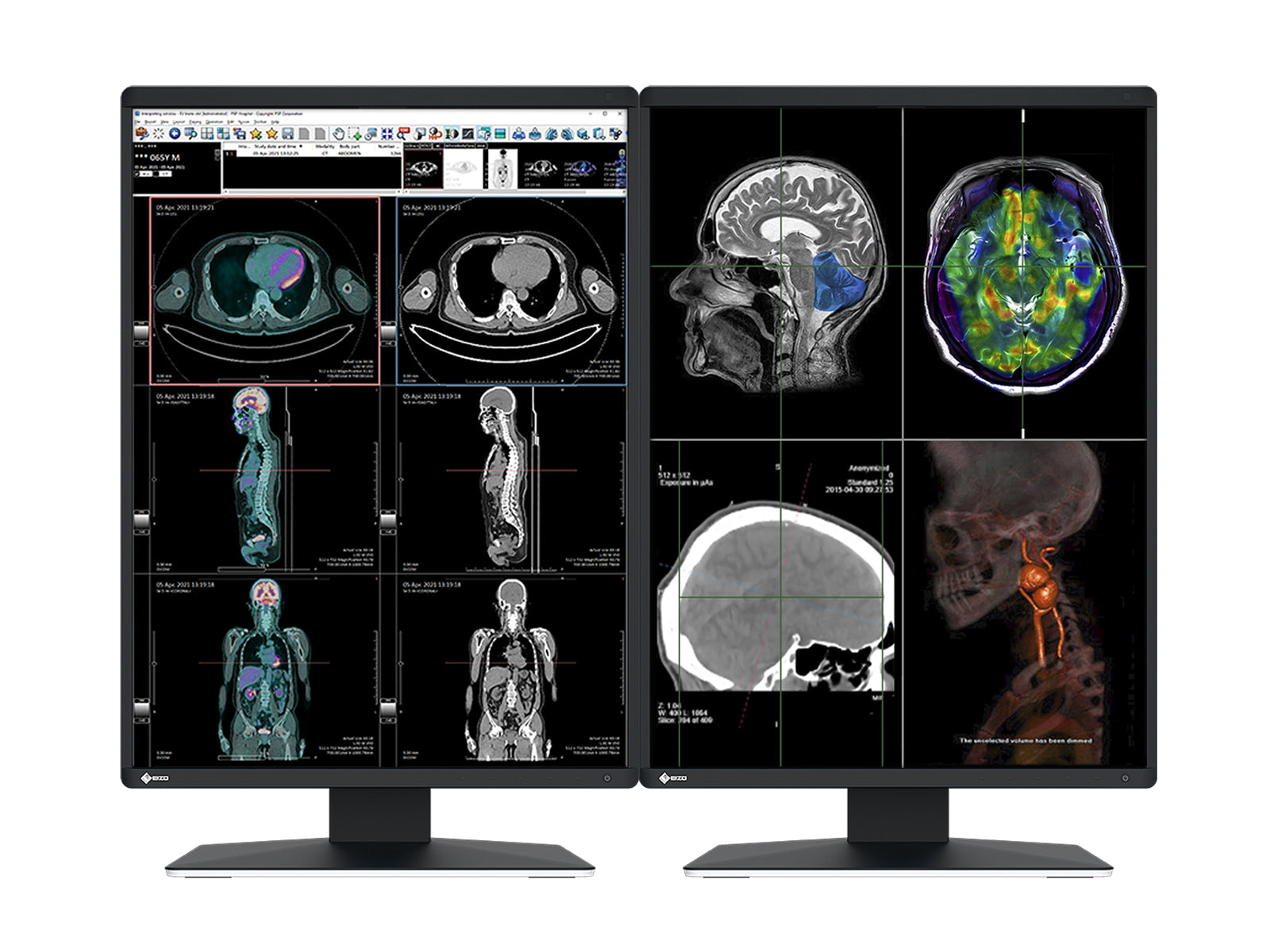 Complete PACS General Radiology Station | Eizo 3MP Color Displays | HP Workstation | Dictation Mic