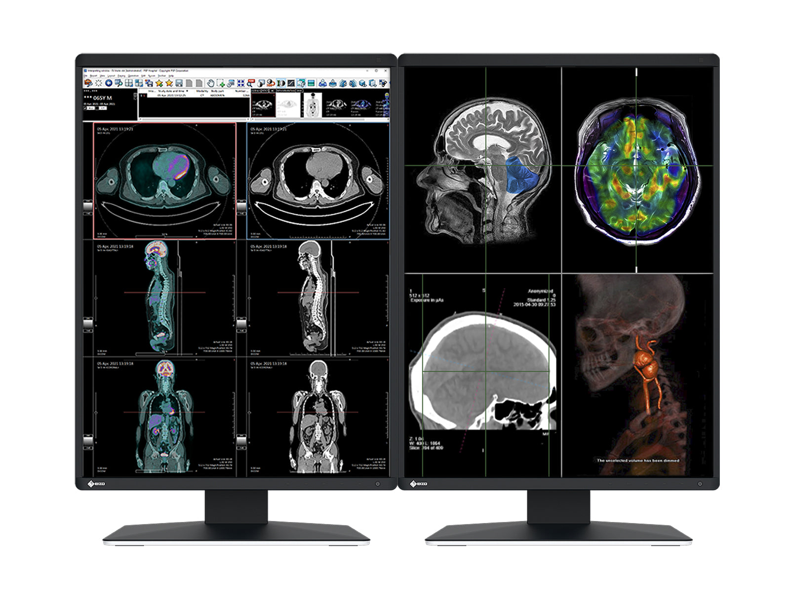 Complete PACS General Radiology Station | Eizo 3MP Color LED Displays | Lenovo Workstation | Dictation Mic | Worklist Monitor (RX370HPZ4) Monitors.com 