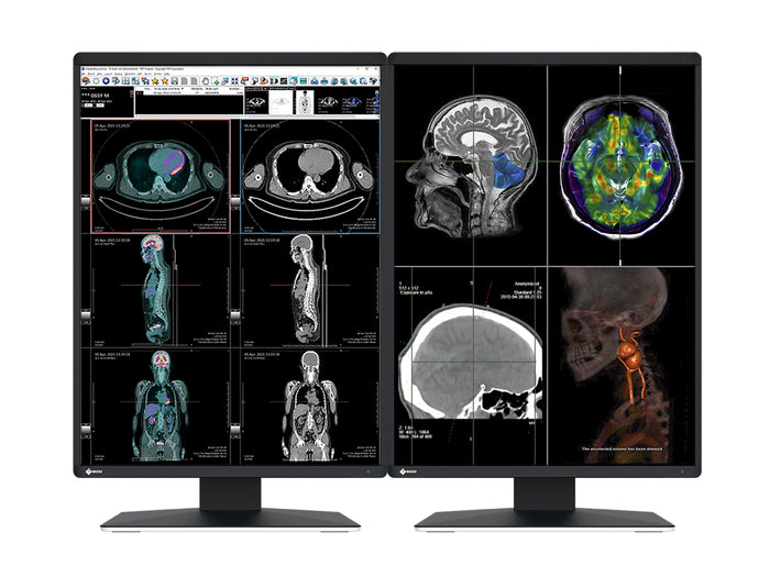 Express Radiology Login Complete PACS Gen Radiology Station | Eizo Displays | HP Workstation