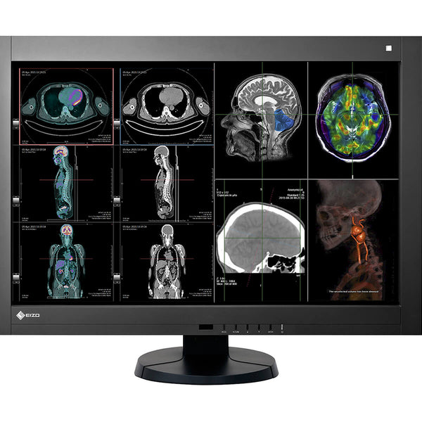 Eizo RadiForce RX440 4MP 30