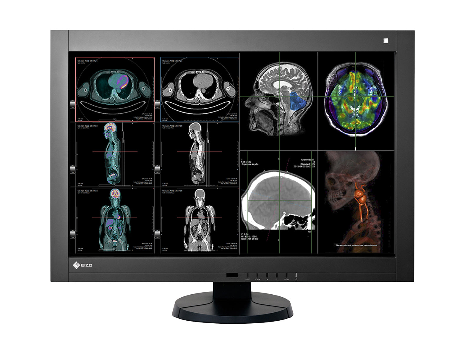 Complete PACS General Radiology Station | Eizo 4MP Color LED Displays | Lenovo Workstation | Dictation Mic | Worklist Monitor (RX440Z4R)