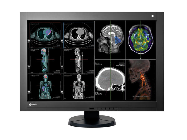 Complete PACS General Radiology Station | Eizo Radiforce RX440 4MP Color LED Displays | Lenovo Workstation | Dictation Mic | Worklist Monitor (RX440Z4R)