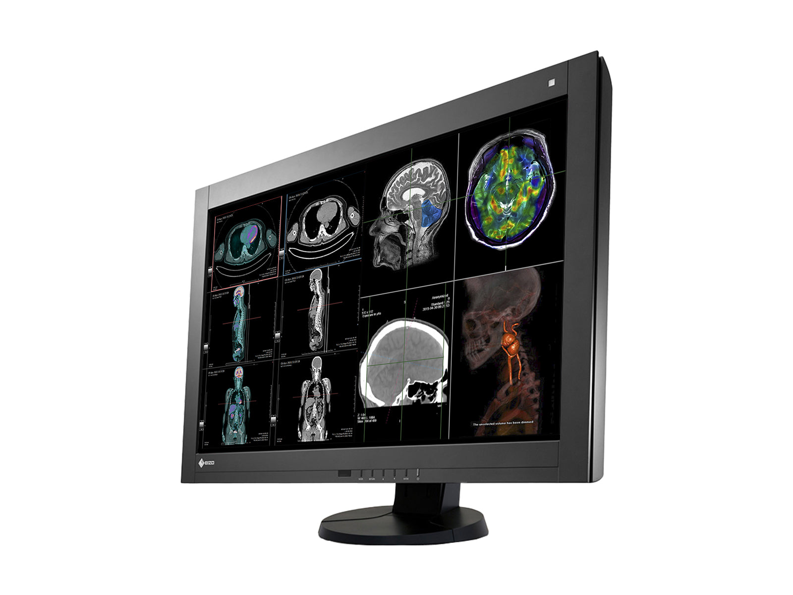 Eizo RadiForce RX440 4MP 30" Farb-LED-PACS-Display für allgemeine Radiologie (RX440-BK) Monitore.com