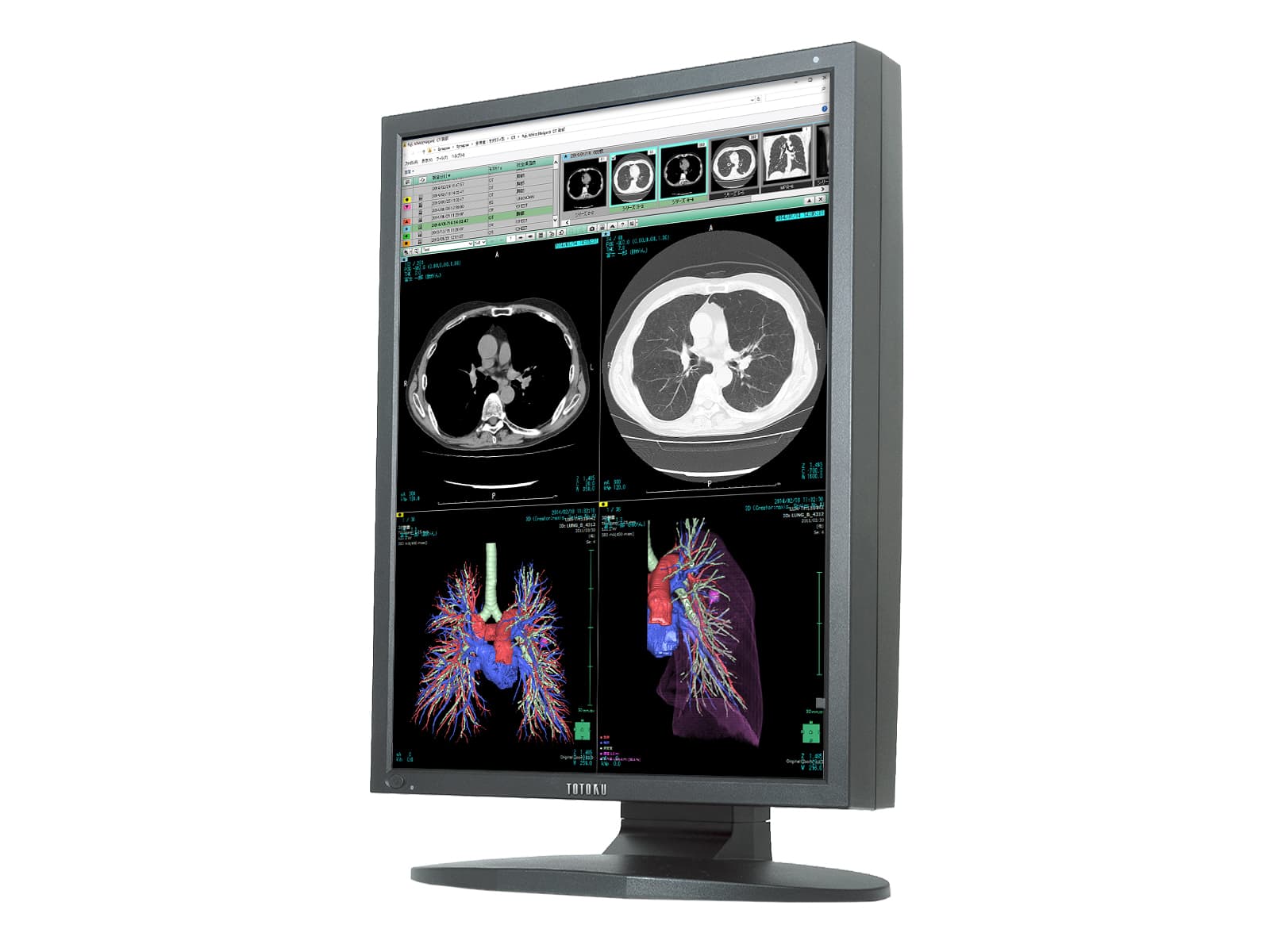 JVC Totoku CCL356i2 3MP 21" Color General Radiology Display Monitor (CCL356i2) Monitors.com 