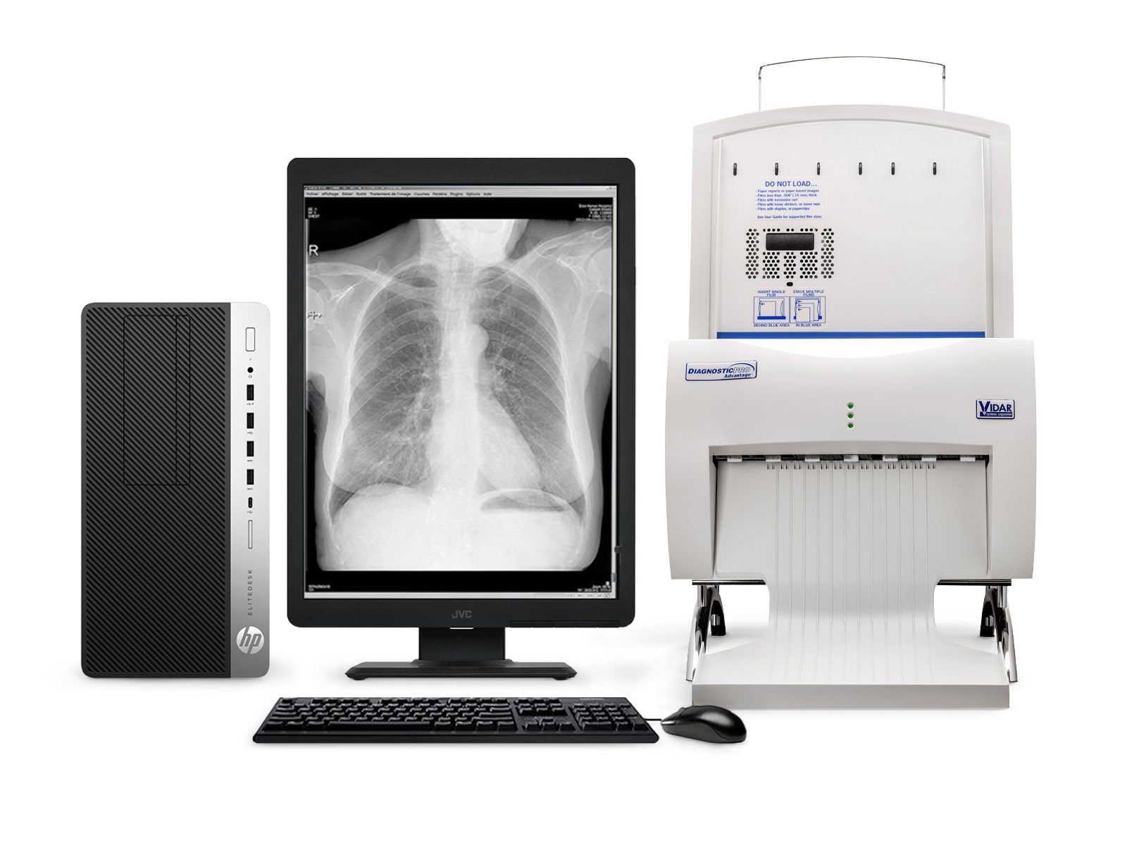 Vidar DiagnosticPro Advantage Allgemeiner Radiologie- und Mammographie-Filmdigitalisierer (16333-004)